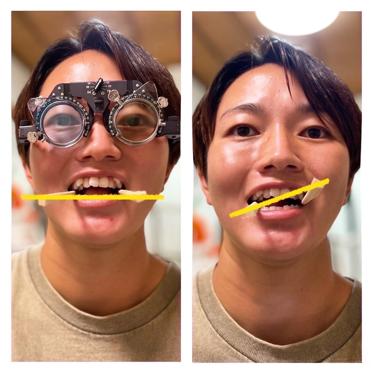 検査写真